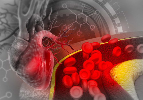 Reducing Risk of Heart Attack and Stroke with Nattokinase